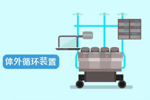 什么是人工心肺機？
